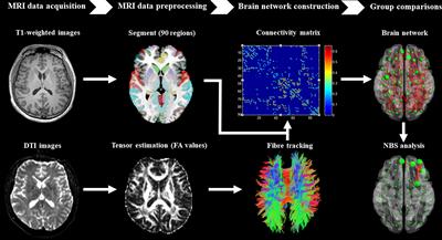 Differences in structural connectivity between diabetic and psychological erectile dysfunction revealed by network-based statistic: A diffusion tensor imaging study